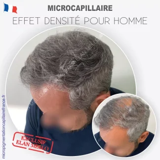 Microcapillaire Effet Densité - Micropigmentation Cheveux