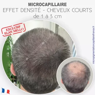 Microcapillaire Effet Densité Sur Cheveux Courts - de 1 à 3 cm - Micropigmentation Cheveux