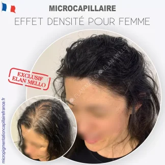 Microcapillaire Effet Densité Pour Femmes - Micropigmentation Cheveux